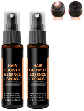 Hair Regrowth Spray, Hair Regrowth Roller+30ml Extra Strength Hair Growth Serum Spray, Hair Regrowth Spray For Women's Men's, Ginger Germinal Oil Stop Hair Loss (2 pcs Spraying)