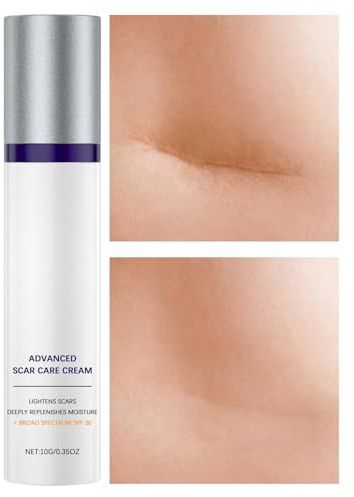 Crema Eliminadora De Cicatrices De Quemaduras | Crema Para Eliminar Queloide | SPF 30 Portátil Reductor de Queloides Hidratante para Recuperación Cutánea en Piel Adulta Corporal
