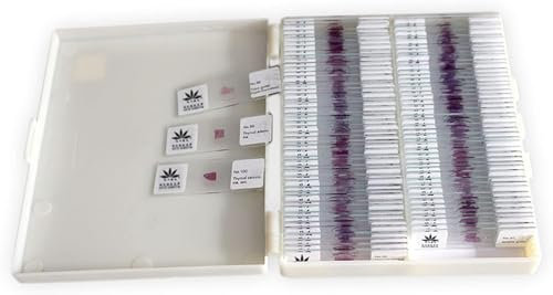 100 Stück präparierte Objektträger für die menschliche Pathologie. Mikroskoppräparierte typische Histologie-Objektträger für den medizinischen Unterricht