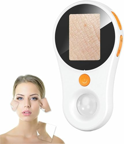 Digitales Mikroskop Dermatoskop mit 2 Zoll IPS Bildschirm, 500X Vergrößerung, Festfokus, Lange Akkulaufzeit, Ideal für Hautbegeisterte