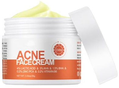 Acne Cream for Face, Gentle Spot Cream for Blemish-Prone Skin, Oil Control & Hydration Moisturiser, Non-Greasy Pimple Cream for Teens & Adults