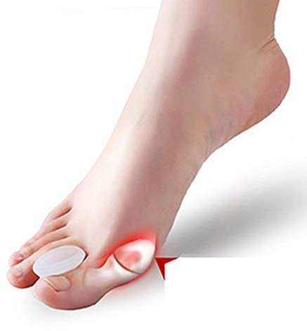 Pedimend 2 Paar große Zehen, Hallux Valgus, Schmerzlinderung, Hammerzehen, Orthesen, Mineralgel-Trenner, Abstandshalter, Trennwand, Silikon, Ballenzeh, Korrektur-Regler