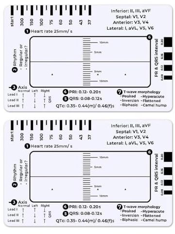 Scheda di righello ECG in plastica a 7 fasi, misurazione accurata, valutazione rapida per l'uso in clinica ospedaliera