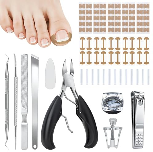 Juego de corrección de uñas encarnadas de 91 piezas con corrección de uñas, quitauñas, alicates, lima de uñas, almohadillas en forma de C, para el cuidado de las uñas de los pies