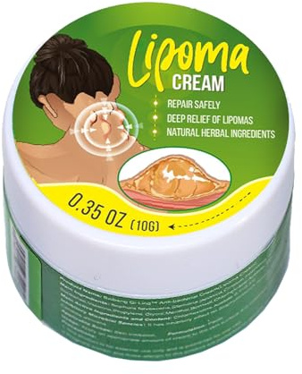 Crème D'élimination Des Lipomes,Lipoma Relieving Cream,Pommade Apaisante pour Les Lipomes,Pommade de Suppression sûre à Utiliser pour Les Gros Morceaux,10g