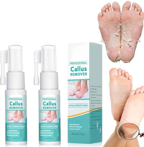 Professioneller Fuß-Hornhautentferner, extra starkes Spray, Fuß-Peeling-Spray, Öl zum Entfernen abgestorbener Haut und Schwielen (2 Stück)