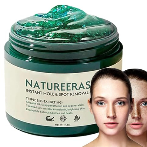 Natureerase Gel Anti-Taupes et Taches Instantané, 50g Crème de Traitement Localisée Professionnelle, Dissolvant de Taupes à L'es-sence Végétale Naturelle, Correcteur de Taches Brunes Hydratant
