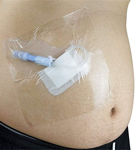 HCCTOZZ Nastro di Fissaggio monouso Impermeabile peritoneale da 100 Pezzi | cerotto da bagno per dialisi peritoneale, copertura per doccia impermeabile postoperatoria, prodotti per(Color: 12*12cm)