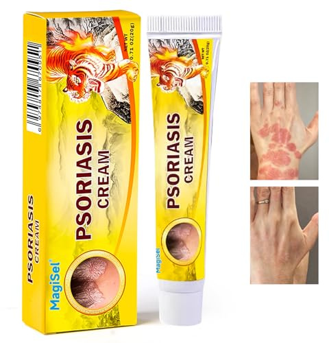 Anti-klåda salva, lugnande hudkräm vid klåda och psoriasis naturlig vård formel, hudkräm, vård och lugnande huden, inte irriterande (20 g)