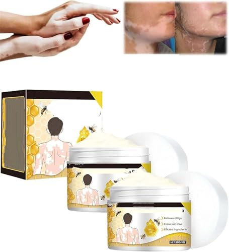 Timilk VitiClear Pro Bee Cream - Crema professionale per la vitiligine, riduce le macchie bianche e migliora la pigmentazione della pelle, uniforma il tono della pelle, ripara idratante, per tutti i