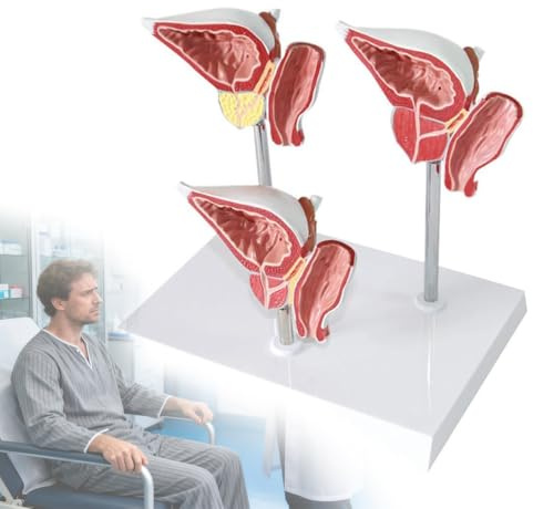 Prostata anatomisk modell, 1:1 manlig urinreproduktivsystem för läkar-patientkommunikation, visar normal/beniga/sjukdomar prostata