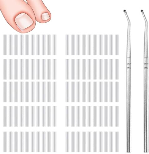 MOLZINY 100 pièces Kit correcteur d'ongles incarnés redressement d'ongles indolores avec lève-ongles Ongles Incarnés Pieds Ongle Incarné Orteil Outil Pour Soins des Pieds