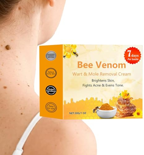 Crema Per La Rimozione Di Talpe Di Verruche Al Veleno D', 2 Pezzi, 30 G Di Crema Per La Rimozione Di Verruche Ed Etichette, Rimozione Di Verruche Ed Etichette Di Veleni Ad Azione Rapida, Crema