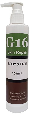 Crema di trattamento per cheratosi pilaris e ipercheratosi con risultati eccellenti