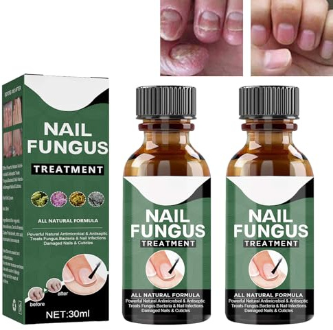 Soluzione per la Cura Delle Unghie,Fungo Unghie Piedi,Soluzione per La Riparazione delle Unghie del Piede,Cura delle Unghie,Liquido per Infezione delle Unghie,Nail Fungus Solution 2PC
