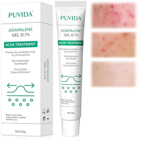 20g Crema Brufoli Viso,Crema per acne,Crema Per Pelli Grasse a Tendenza Acneica,Riduce Imperfezioni e Sebo,Per la maggior parte dei tipi di pelle,Uomini e donne