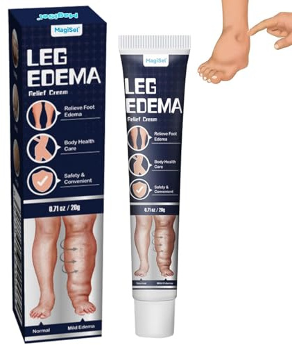 Crema edema, Crema Vene Varicose, cellulite edematosa, per edema osseo, Migliora la Circolazione Sanguigna Cura Delle Vene varicose, Rafforza la Salute dei Capillari 20g