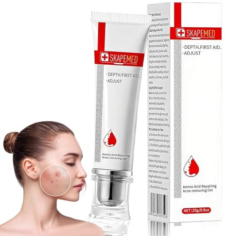 25g Gel Anti-Acné, Ayuda a Prevenir Granos y Marcas, Reduce las Manchas, Textura Ligera, Mejora la Apariencia de la Piel