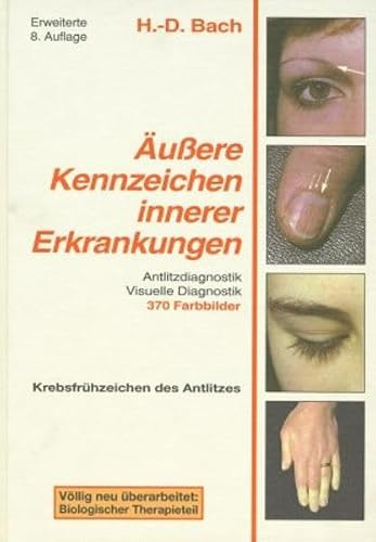 Antlitzdiagnostik: Äußere Kennzeichen innerer Erkrankungen, Bd. 1: Lehrbuch und Farbatlas für Pathophysiognomie und visuelle Diagnostik