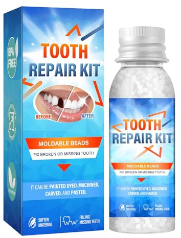 Mnozreo Perline Temporanee di Riparazione Dentale,Granuli di Riparazione dei Denti,30ML,1PC,Cemento per Denti,per Otturazioni,Cavità e Denti Scheggiati