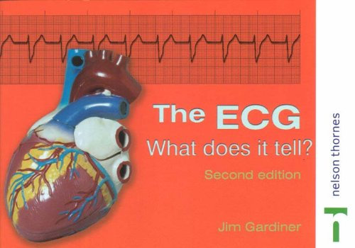 The ECG: What Does It Tell?