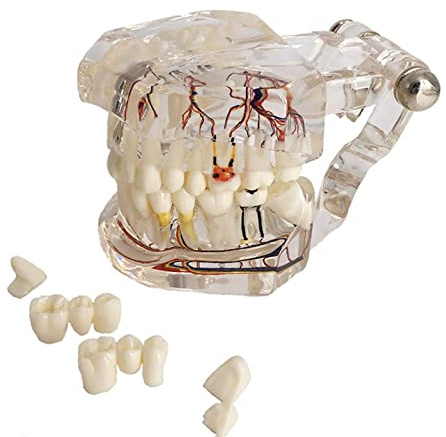 YOUYA DENTAL Neural reparation tandmodell implantat sjukdom tänder modell tandläkare standard patologiska avtagbara tänder undervisningsmodell för tandläkare skola utbildning lärande
