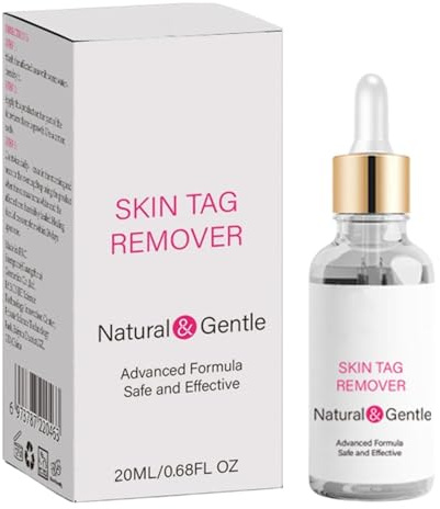 Rimozione Neo Cutaneo,Liquido 20 ml per Rimozione Imperfezioni - Soluzione per Nei Cutanei - Per Uomo Donna Spalle Schiena Mani Piedi Viso Collo Braccia Gambe