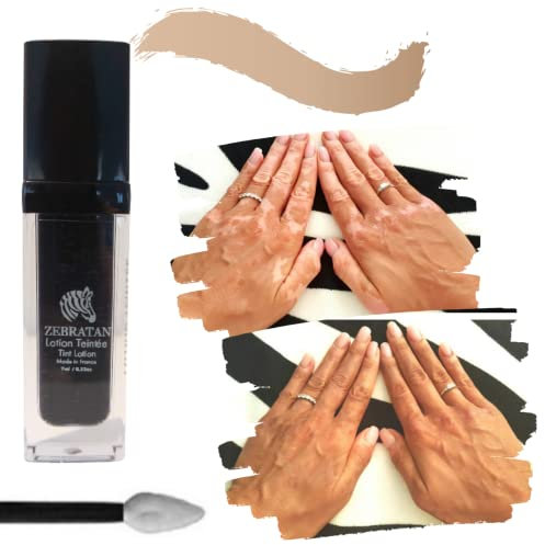 Trucco vitiligine su misura Zebratan - 7ml Beige Marrone - Lozione autoabbronzante - non grassa, non un fondotinta - mimetico piastre