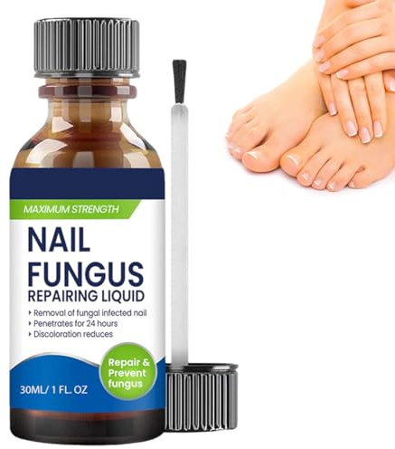 1 Pièces Vernis à Ongles - Traitement Mycose Ongle Pied Puissant - Vernis Antifongique pour les Ongles Décolorés, Endommagés et les Ongles épais,B