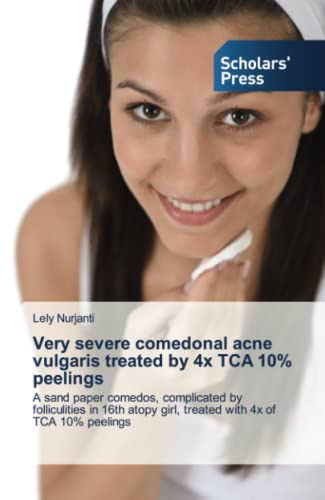 Very severe comedonal acne vulgaris treated by 4x TCA 10% peelings: A sand paper comedos, complicated by folliculities in 16th atopy girl, treated with 4x of TCA 10% peelings