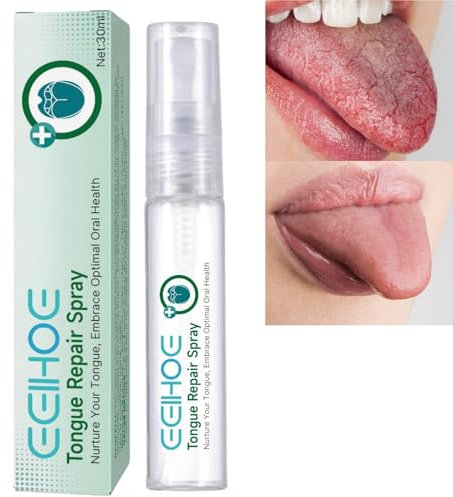 Tongue Repair Spray,Sore Tongue Relief,Mint Breath Spray,Breath Freshener Spray,Instant Dry Mouth Relief,Tongue Relief Treatment,Tongue Repair Spray for Dryness, White Coating and Bad Breath