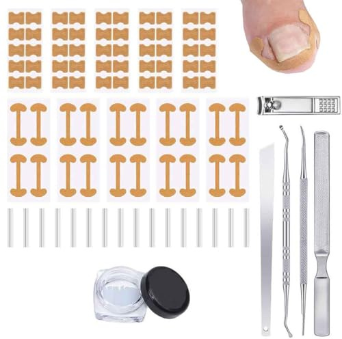 Set correttore per unghie incarnite,Correzione Dell'unghia del Piede,Foglio Correttore per Unghie Incarnite,Cerotti per Unghie,strisce correttive,Strumenti per Pedicure