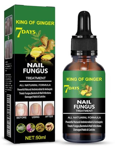 Nail Fungus Treatment - Ginger Nail Fungus Treatment - Nail Strengthener For Damaged Nails - Nail Growth Supporter To Repair Cracked, Yellow, Weak Nails