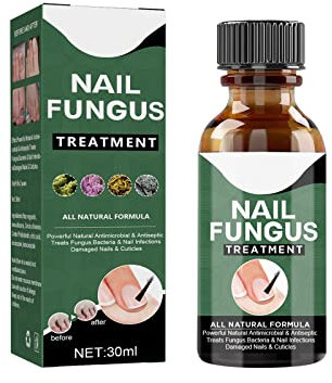 BYNYXI Líquido de reparación de uñas, Solución de Uñas Micóticas Tratamiento de Uñas de Los Hongos Apto para Dedos y Pedicura, Cuidado Profesional Pie/Mano - 30ML
