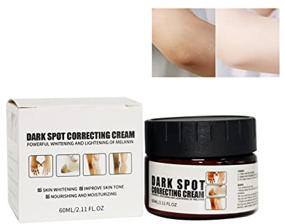 AcanthoGlow Therapiecreme,Dunkle Knie und Ellbogen Starke Aufhellungscreme,Snow Bleach Cream for Private Part Underarm Whitening,Hellere Körperschwarze Haut Für alle Menschen geeignet