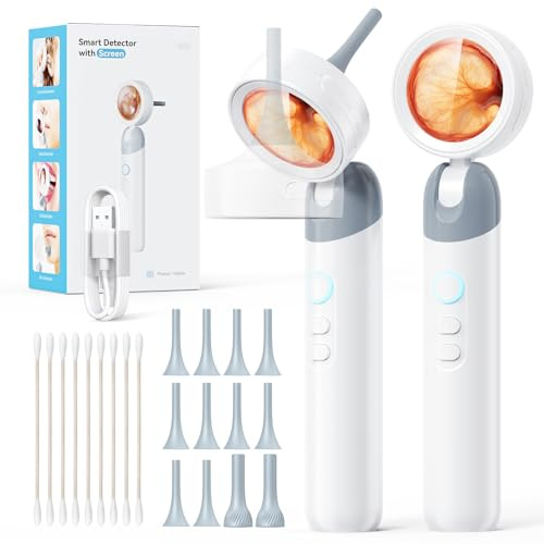 Qimic 1,3v8 Otoskop mit Licht, Ohr Infektions Detektor und Tragbares Hand-Otoskop, leichtes Diagnostik Ohrpflege-Tool für Kinder, Erwachsene, Haustiere, Heimgebrauch, 2000mAh Akku