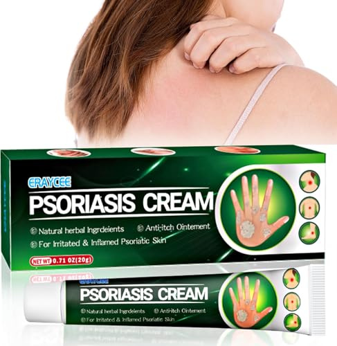 Crema Antifúngica 20 g,Aliviar el Picor Enrojecimiento de las Irritaciones Cutáneas en el Cuerpo la Cara