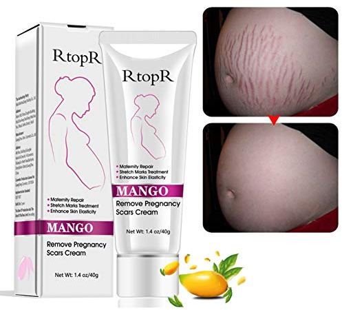Stretch Marks Cream Narbencreme, Narbencreme Entfernung Creme, Körper Reparatur Creme Dehnungsstreifen Reparatur Körper Haut Moisturzing für Frauen nach Schwangerschaft,40g