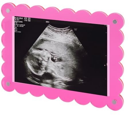BOXOB Gewellter Magnetischer Bilderrahmen Acryl, 18x13cm Fotorahmen zur Schwangerschaftsankündigung Andenken zur Bekanntgabe des Geschlechts Geschenk für Werdende Eltern (Rosa)