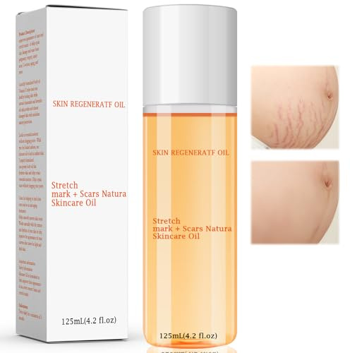 Aceite De Corporal Antiestrias Embarazo,Reparación Postnatal Desvanece La Cicatriz Aceite Para El Cuidado De La Piel Seca,Aceite Corporal Estrias Embarazo Y Antiestrias Embarazo,125ML