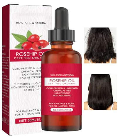 Hagebuttenöl BIO Kaltgepresst - 100% Reines Wildrosenöl | Gesichtsöl gegen Falten & Narben | Pflegendes Öl für Haut, Haare & Nägel, Reduziert Dehnungsstreifen & spendet Feuchtigkeit (30ml)