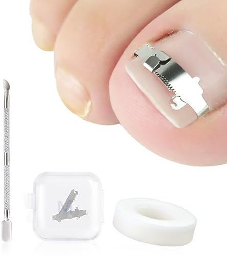 3 Piezas Set Corrector Uñas Encarnadas, Uñas Encarnadas Pies Corrección | Herramientas Correctoras con Soportes, Corrección de Uñas de Los Pies, para el Tratamiento de la Paroniquia