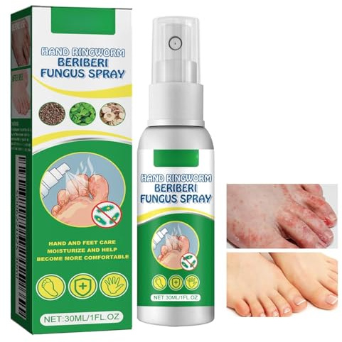 Spray para Pies, Spray para Pie de Atleta, Spray para el cuidado de los pies, Hidratante y reparador, Mujeres y Hombres Adultos, 30ml
