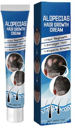 Alopecia Haarwachstumscreme, Natürliche Haarpaste, Haarverdickungscreme, Natürliche Formel, Kompakte Bequemlichkeit, 20 G, Für Männer Und Frauen, Erwachsene