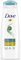 Dove Ultra Care Daily Moisture Shampoo strengthens and moisturises for up to 10x more resilient hair* for everyday hair care 250 ml