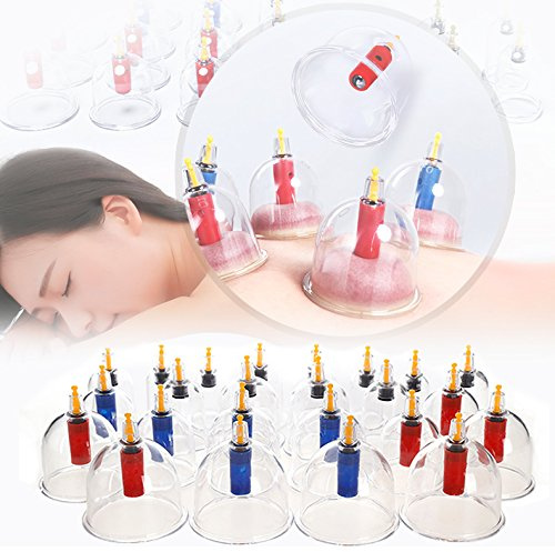 Flyelf Schröpfen Set Vakuum Massage Mit 24 Schröpfgläser-Cupping Set aus Kunststoff