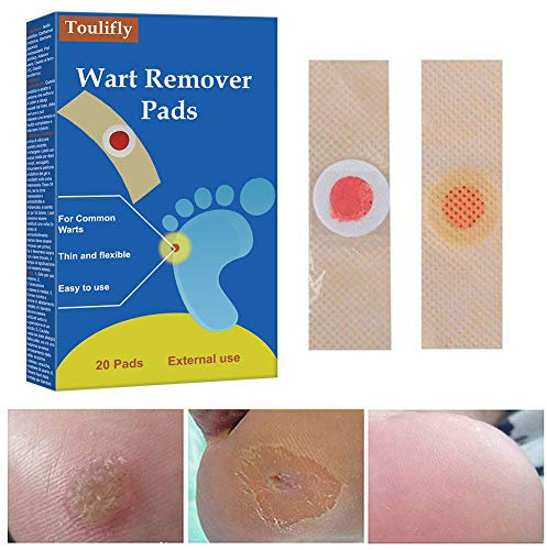 Rimozione per verruche, trattamento per rimozione verruche, rimozione calli, rimozione calli dei piedi, rimozione verruche plantari, penetra e rimuove verruche comuni e plantari e calli