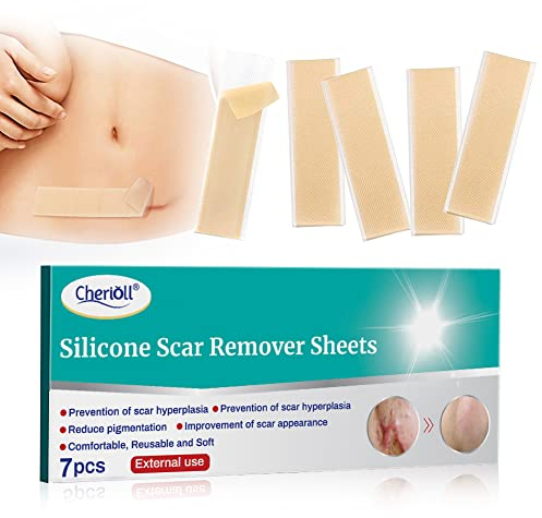 Silicone Scar Removal Sheets,Feuilles pour enlever les cicatrices, Feuilles pour enlever les cicatrices en silicone, pour les coupes en C, traite et prévient les cicatrices surélevées et décolorées