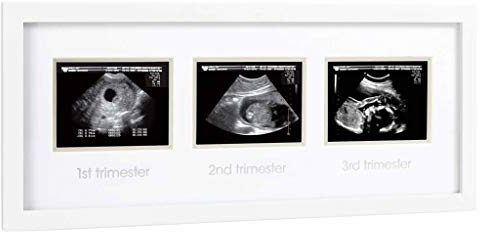 Pearhead Pregnancy Trimester Sonogram Frame, Ultrasound Picture Frame, Pregnancy Milestone Keepsake Photo Frame, Sonogram Keepsake, Gender-Neutral Baby Nursery Décor, 1st 2nd and 3rd Trimester, White