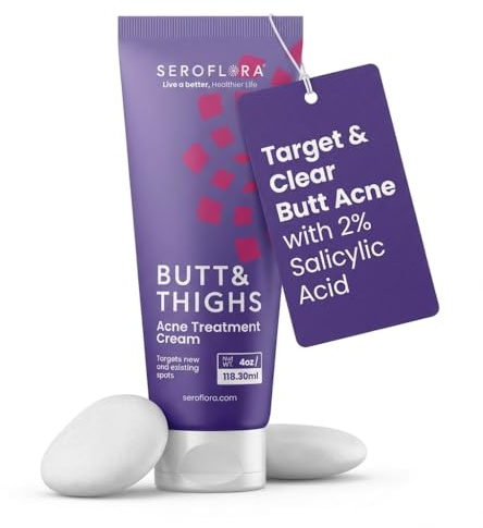Butt Acne Clearing Treatment Cream - Reduce Bum Acne, Pimples & Zits - Clearing Acne Lotion for Buttocks - 2% Salicylic Acid for Acne Prone Skin (4oz) Made in USA.